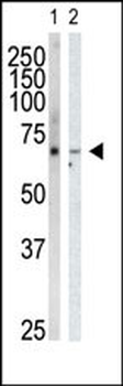 GRK6 Antibody (C-term)