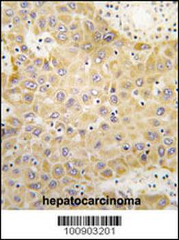 GRK5 Antibody (C-term)