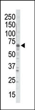 GRK5 Antibody (C-term)