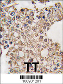 GRK4 Antibody (C-term)