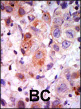 ADRBK1 Antibody (C-term)
