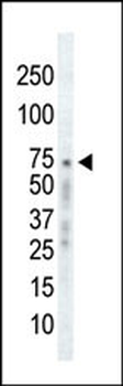 ADRBK1 Antibody (C-term)