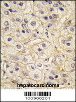 GRK1 Antibody (C-term)