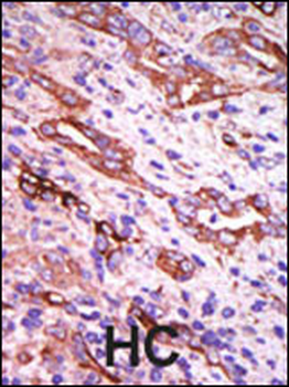 GRK1 Antibody (C-term)