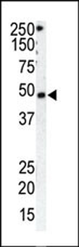 GRK1 Antibody (C-term)