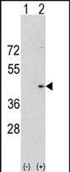 Aurora-A Antibody (C-term)