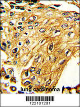 IFNGR2 Antibody (C-term)