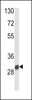 NAT2 Antibody (C-term)