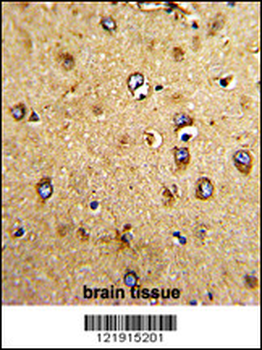 HOMER3 Antibody (Center)