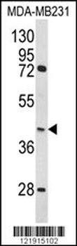 HOMER3 Antibody (Center)