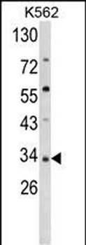 SFRP5 Antibody (Center)