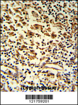 HMHA1 Antibody (Center)