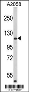 HMHA1 Antibody (Center)
