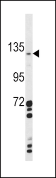 CLEC16A Antibody (Center)