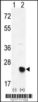 MSRB2 Antibody (Center)