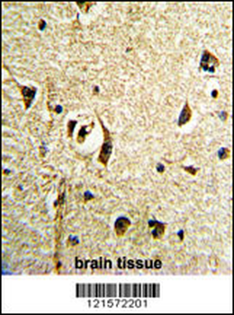 FTO Antibody (N-term)