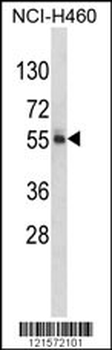 FTO Antibody (N-term)
