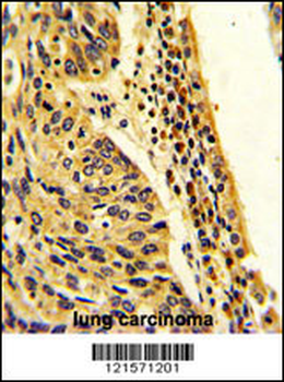 FPGS Antibody (Center)