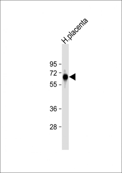 FPGS Antibody (Center)