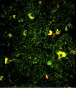 Rab5 Antibody (C-term)