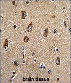 Rab5 Antibody (C-term)