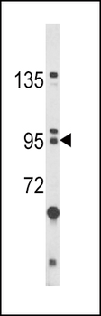 BICC1 Antibody (N-term)