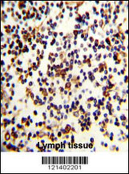 CR2 Antibody (C-term)