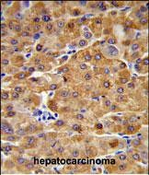 CBS Antibody (N-term)
