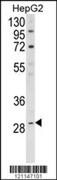 DIO1 Antibody (N-term)