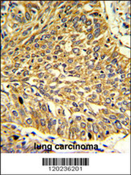 RGP1 Antibody (C-term)