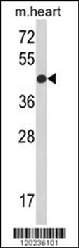 RGP1 Antibody (C-term)