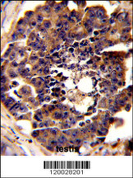PDRG Antibody (N-term)