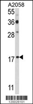 PDRG Antibody (N-term)