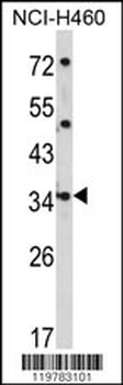 CER1 Antibody (N-term)