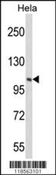 PIK4CB Antibody (Center)