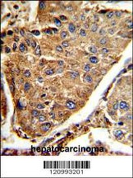 HEXA Antibody (Center)