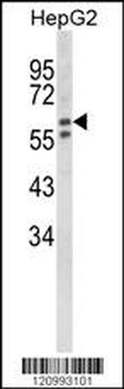 HEXA Antibody (Center)