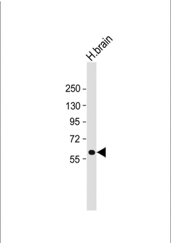 HEXA Antibody (N-term)