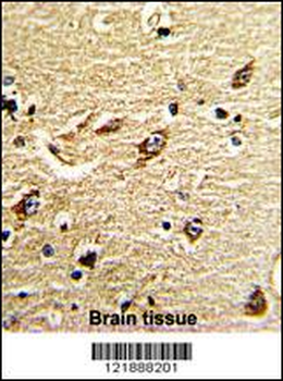 ND5 Antibody (C-term)