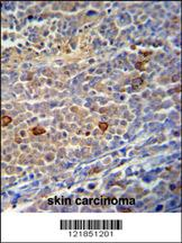 C9orf156 Antibody (C-term)