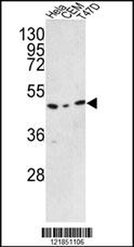 TRMO Antibody (C-term)