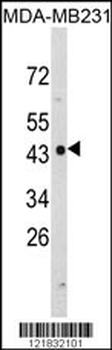 NDRG1 Antibody (N-term)