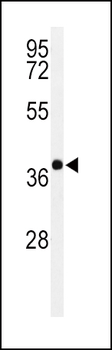 PAX6-T373 Antibody