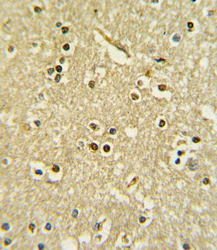 PAX6 Antibody (Center)