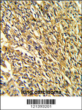 KCNJ2 Antibody (C-term)
