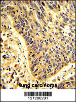 MyoGEF Antibody (N-term)