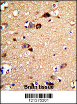 UNC5C Antibody (Center)