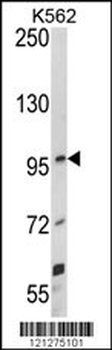 UNC5C Antibody (Center)