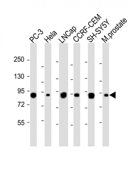 TGM4 Antibody (Center)