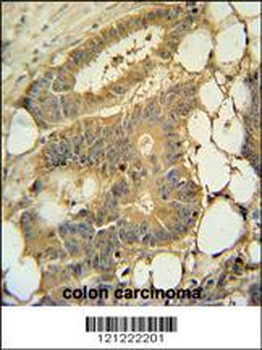 EPS8L3 Antibody (N-term)
